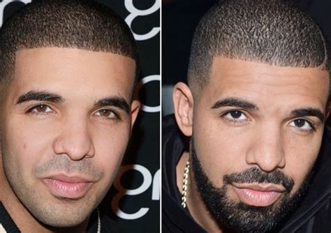 drake dick surgery|did drake have plastic surgery.